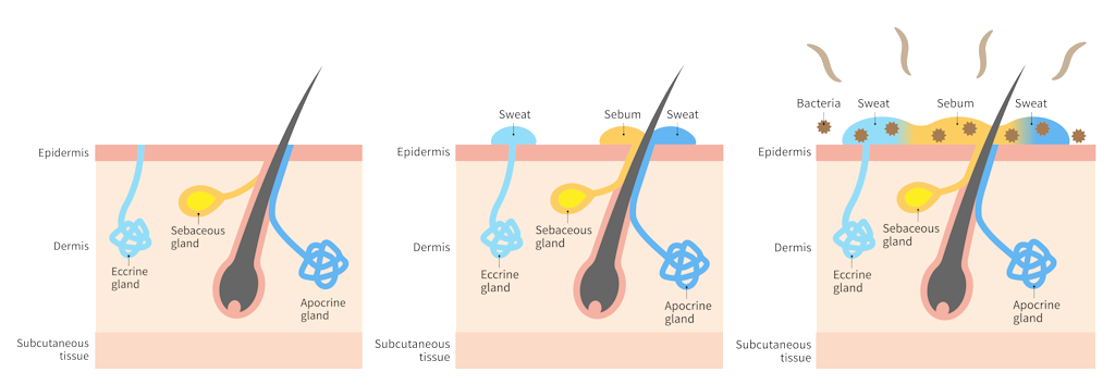 Image of sweat glands under he skin