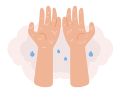 Image of sweaty hands